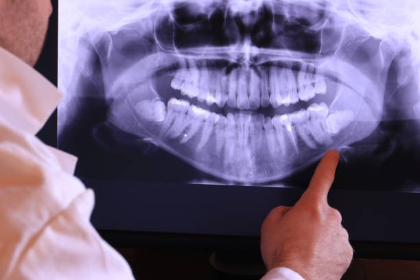 Best Broken or Cracked Tooth Emergency Dentist in Castle Point, MO