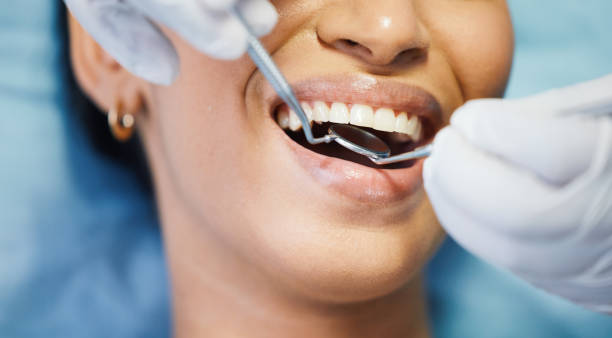 Best Emergency Dentist for Special Needs Patients in Castle Point, MO